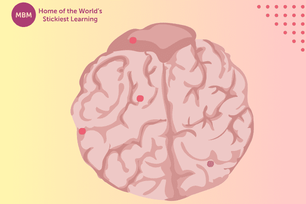 Brain graphic with pink and blue dots for aggressive behaviour